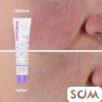 Topicrem spf 50 от розацеи