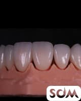 Скидки! Металлокерамика, цирконий. Импланты Южная Корея